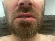 BeardedMan22