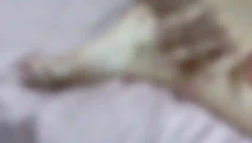 Bewerte abbys körper.