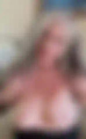 Showing scars from breast reduction years ago. Rebuilt breasts. 1,000 stitch scars