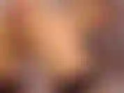 Anal 1 (furz, prolaps, gape).