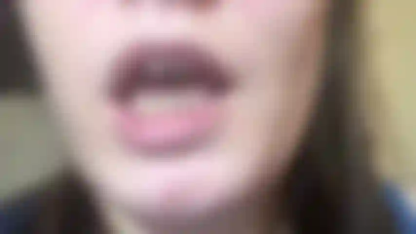 Schäumende spucke necken.