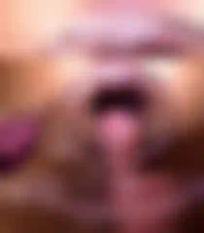 Muschiinspektion, gape, prolaps, arschloch, spekulum.