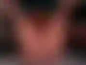 Epic spritzt ein paar mal.